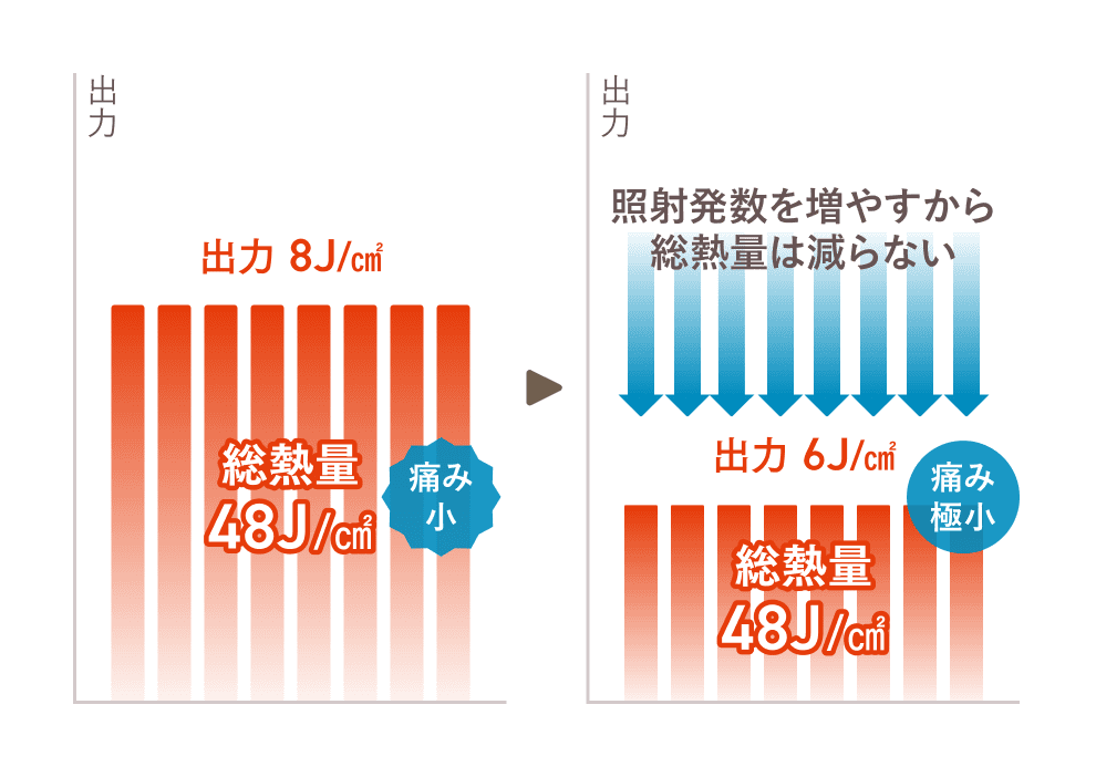 蓄熱式脱毛は、1回の施術の中で同じ場所に複数回レーザーを照射してOK。出力を下げて痛みを抑えても、照射数を増やせば効果は落ちません。